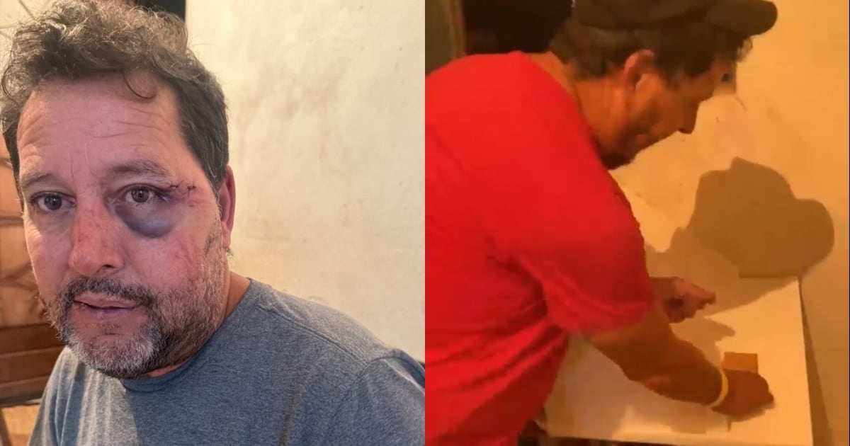 Homem denuncia agressões de policiais militares durante abordagem dentro de casa em Sabará